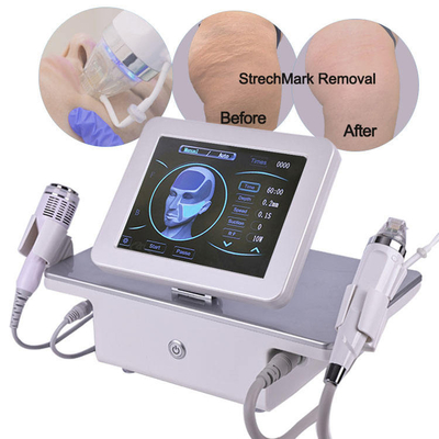 Portable RF Radio Frequency Machine Microneedling Fractional Stretch Marks Wrinkle Removal