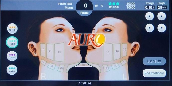 3.0mm 4.5mm 2D HIFU Slimming Machine Skin Tightening Wrinkle Removal