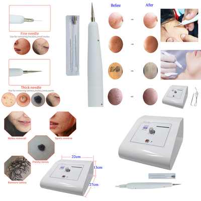 Face Pore Cleaner Skin Tag Removal Machine 110V 220V 12W CE Certified